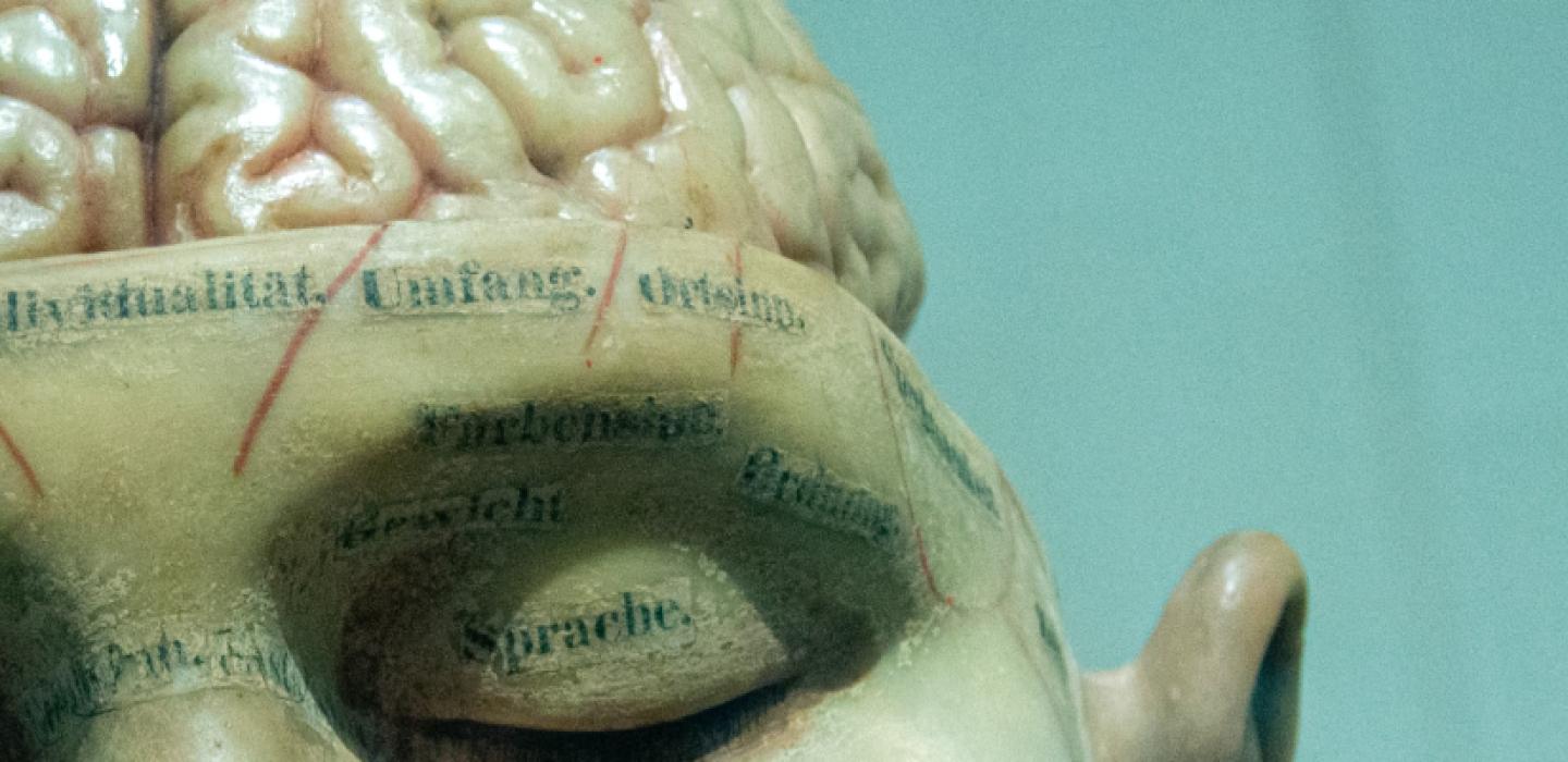 3-d model of a head with brain exposed